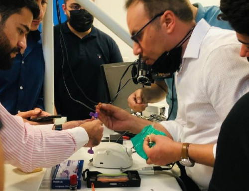 Hands on Direct Composite Veneer
